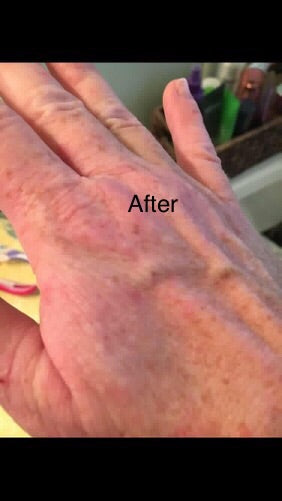 No More Eczema Organic Handmade Soap Sweet Harvest Farms Sweet Harvest Farms Everetts Place: Online Boutique
