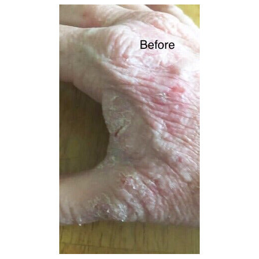 Sweet Harvest Farms No More Eczema Organic Handmade SoapEveretts Place
