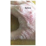 Sweet Harvest Farms No More Eczema Organic Handmade SoapEveretts Place
